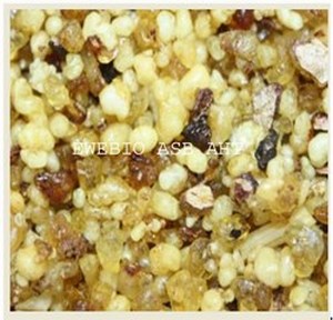 Laryngite: definition, symptômes ,cause et traitement naturel