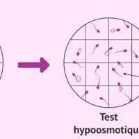 Nécrospermie Solution Naturelle Nécrospermie
