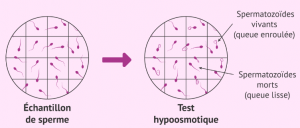 Nécrospermie Solution Naturelle Nécrospermie