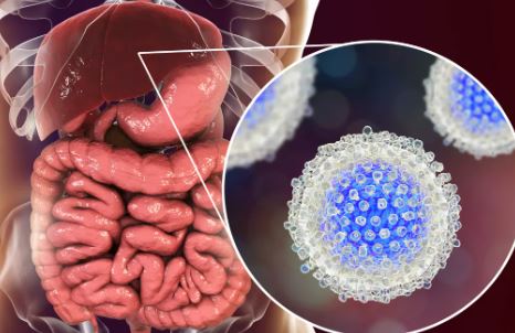 Tout Savoir sur Hépatite C : Hépatite C et Traitement Hépatite C